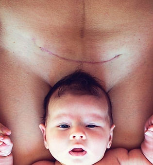 Cesarean-Section-C-Section-Mother-and-Baby-684562154_1258x836-1_edited.jpg