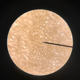 Observation au microscope d'une peau de banane
