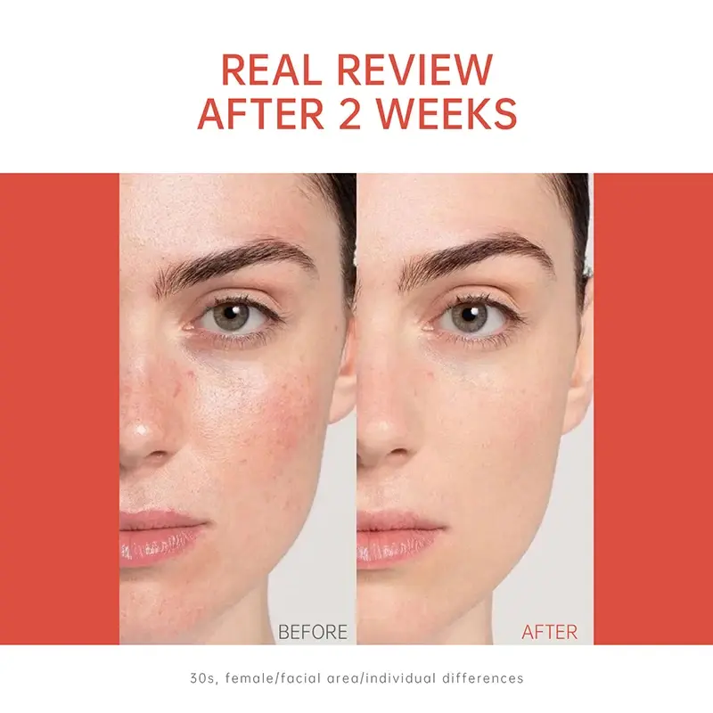 Thumbnail: PDRN Salmon DNA Cellular Repair Serum