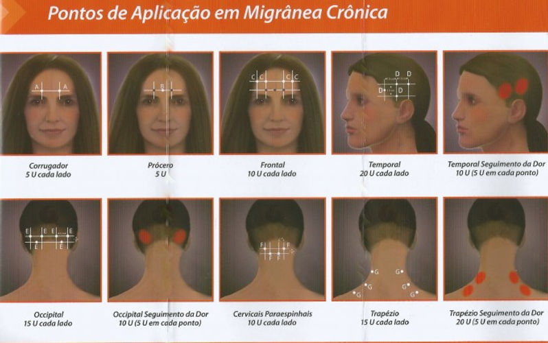 Migranea2-680x458.jpeg
