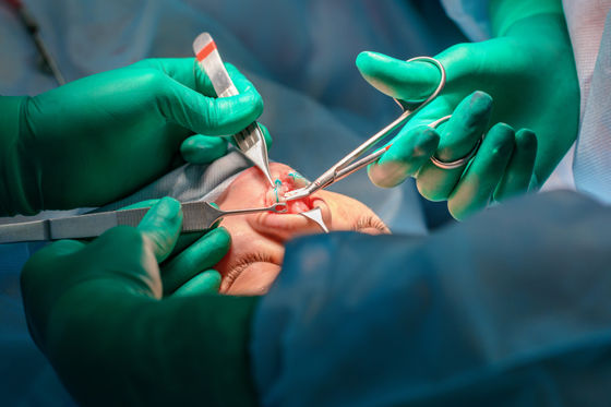 What Happens During a Rhinoplasty Surgery? 3 Steps For A Rhinoplasty Procedure