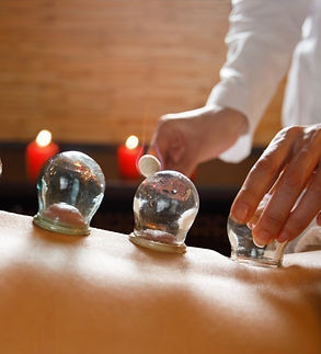 hijama 11.jpeg