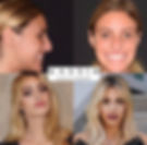 LELE+PONS3
