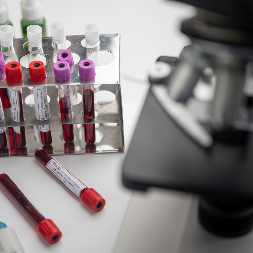 שיחת ייעוץ טלפונית על בדיקות דם עם סיגל