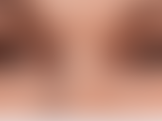 How to Get Rid of Under-Eye Wrinkles: A Treatment Guide for Malaysian Skin