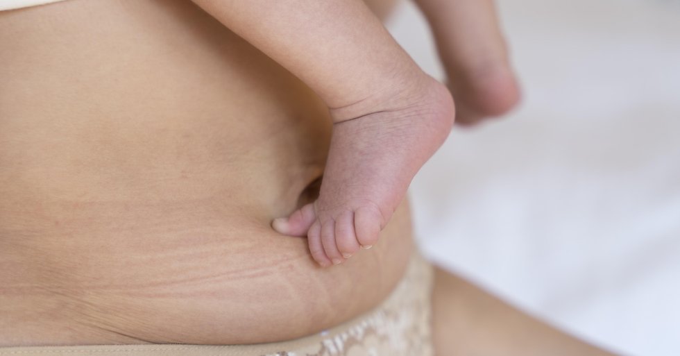 Body Tightening After Pregnancy: Non-Surgical Options in Malaysia