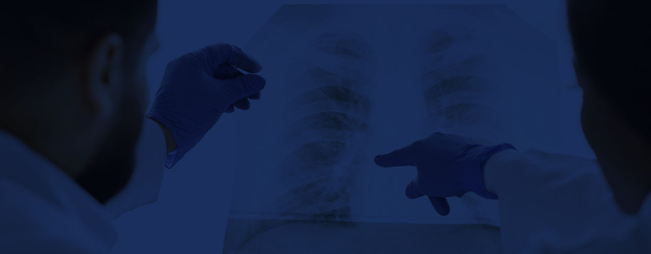 laboratorio pulmonar.jpg