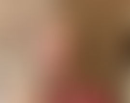 smiling female acupuncturist