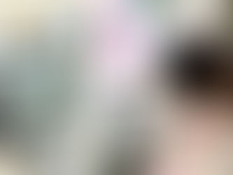 セレック・プライムスキャン(光学印象の機械)の画像