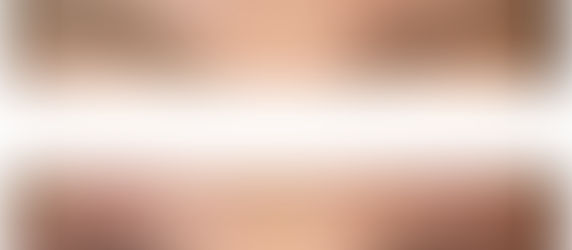 【人気の眉毛脱毛!】