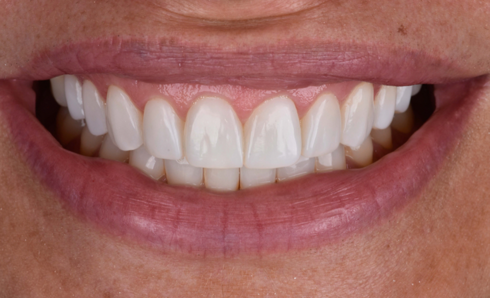 Screenshot 2026-01-16 at 21.43.45.png