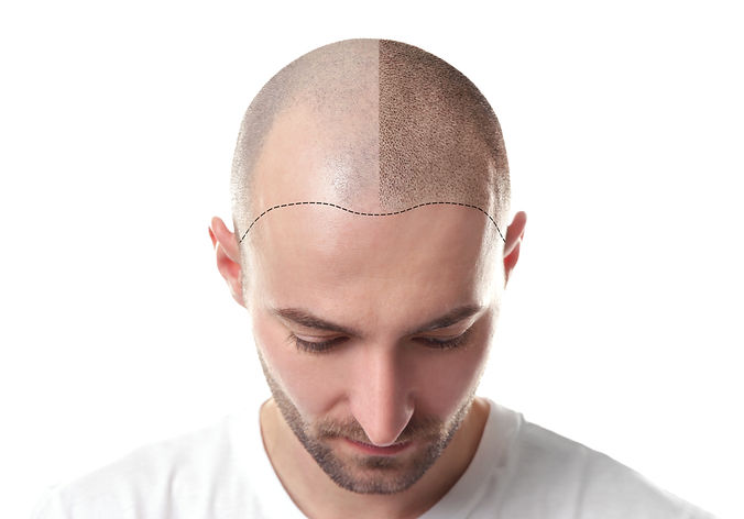624234857.jpg