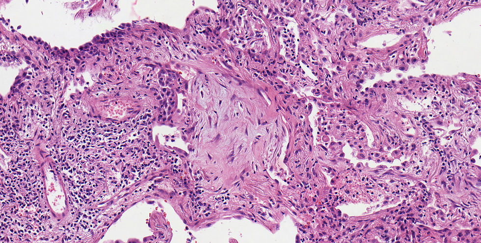 peribronchiale Mesenchymknospe 20x.jpeg