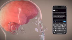 Neuralink Projects USD 1 Billion Annual Revenue by 2031 with Brain Implant Expansion