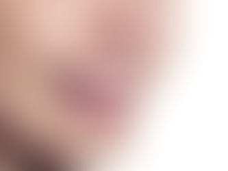 From Gold to Metal: The Answer to When Were Braces Invented