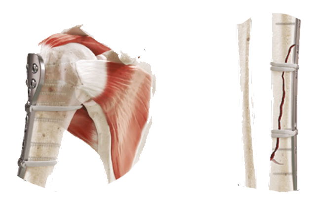 to_strapflex_eng-5