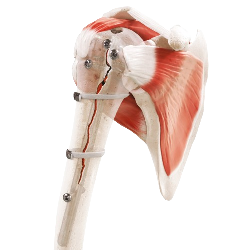 strapflex_ms_1