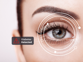 How AI Can Accurately Detect Diabetes Through Retinal Images