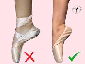 The Truth Behind Flat Feet: The Biomechanics of the Foot and Ankle in Ballet