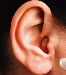 cic-hearing-aid_edited.jpg