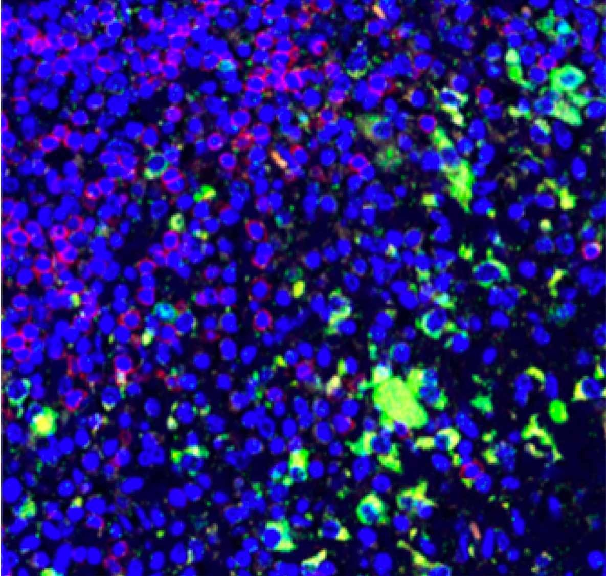 Gastrointestinal Tumor Microenvironment and Metastasis