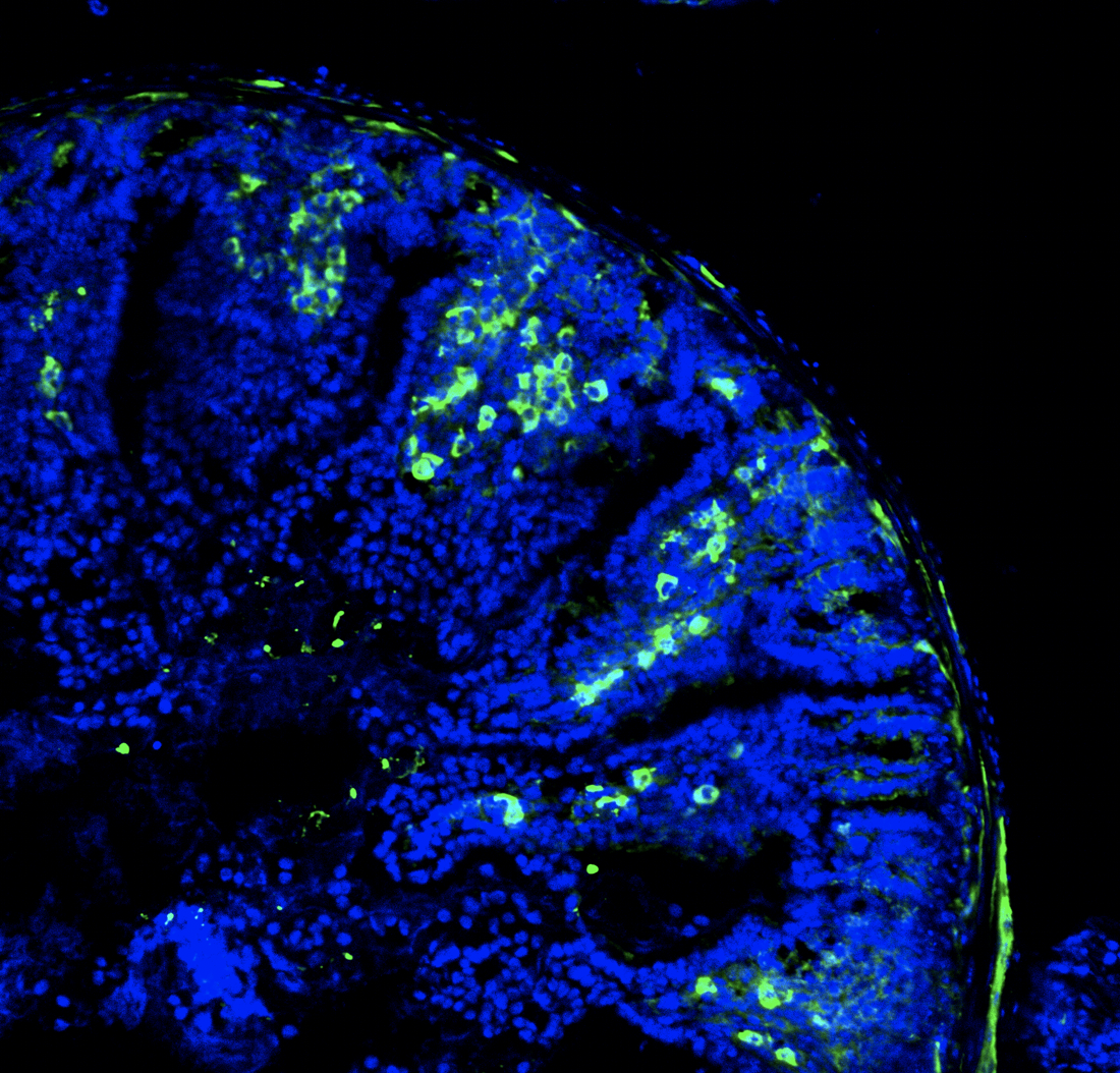 Enteric Nervous System and the Gut-Brain Axis