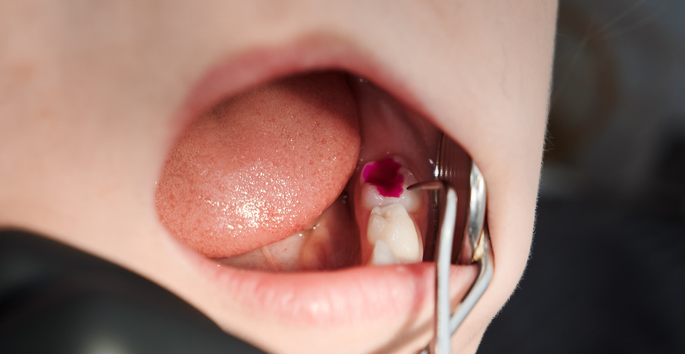 stomatologist-hands-examining-child-teeth-dental-office.jpg