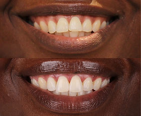 perfect smile_edited.jpg