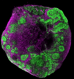 #385_wibj2_DAPI_TUBB3_SOX2_merged in Fiji.tif (RGB) (RGB).tif