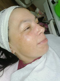 הצערת העור גולד קוסמטיקס נוף הגליל