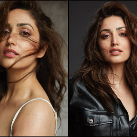 यामी गौतम ने अपनी स्किन समस्या के बारे में की बात; इंस्टाग्राम पर पोस्ट की साझा की तकलीफ