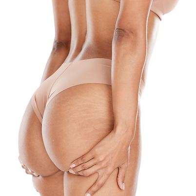 REDES SOCIAIS (7)_edited.png