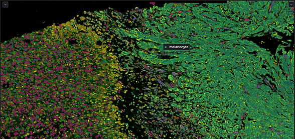 Interactive Xenium data analysis CDIAM software_edited.jpg