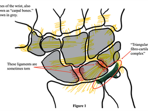 WRIST ARTHROSCOPY