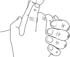 POSTOPERATIVE EXERCISES FOR CARPAL TUNNEL DECOMPRESSION AND TRIGGER FINGER RELEASE