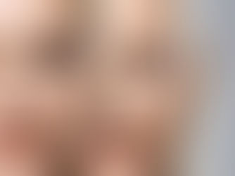 PDO Mono Threads vs PDO Cog Threads Which is Right for Your Aesthetic Goals