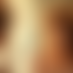 Bad Hair, Big Pimple—Nobody Cares But You!