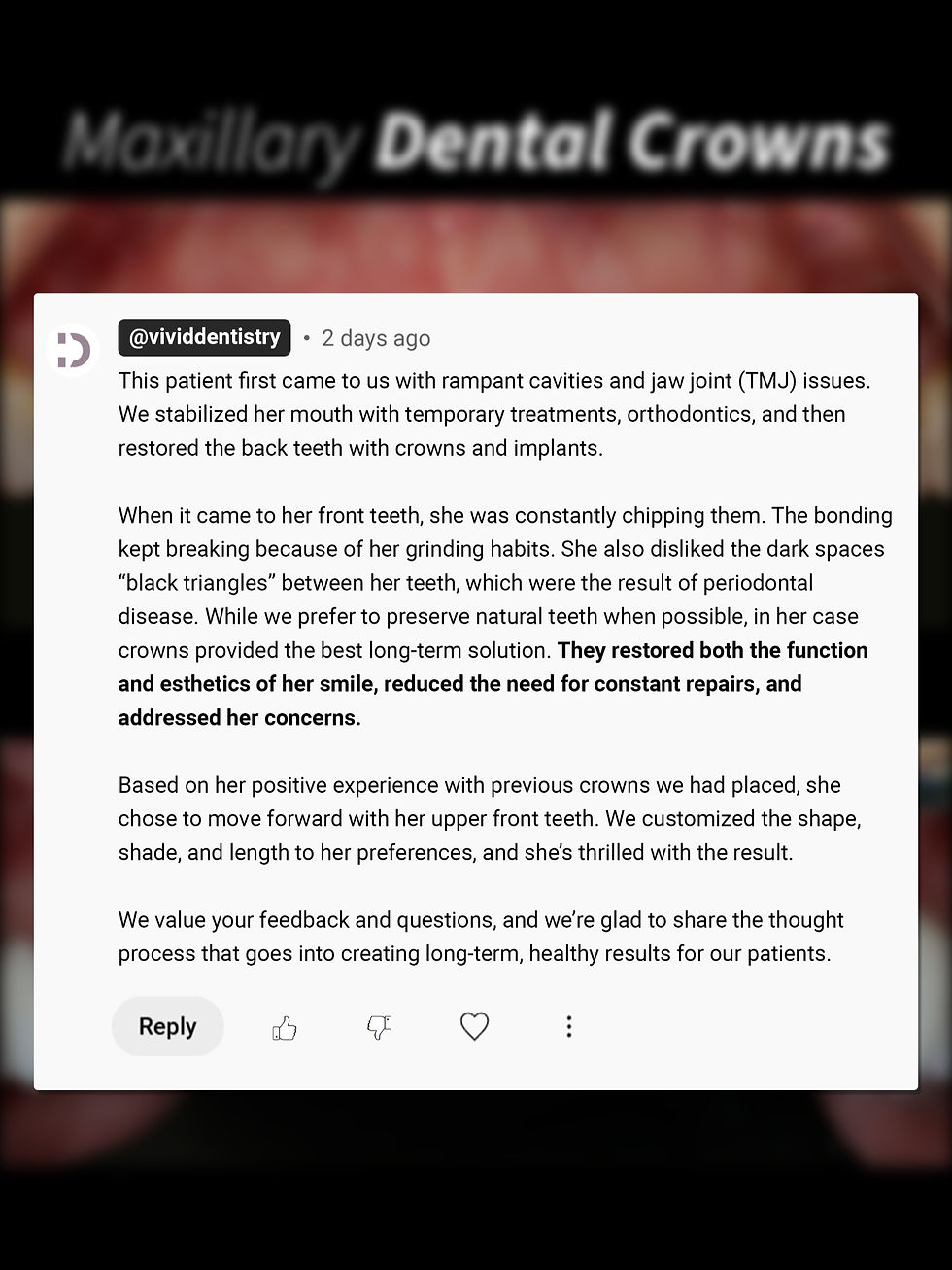 Full Mouth Dental Crown Comment "Dr. Sumar's Answer"