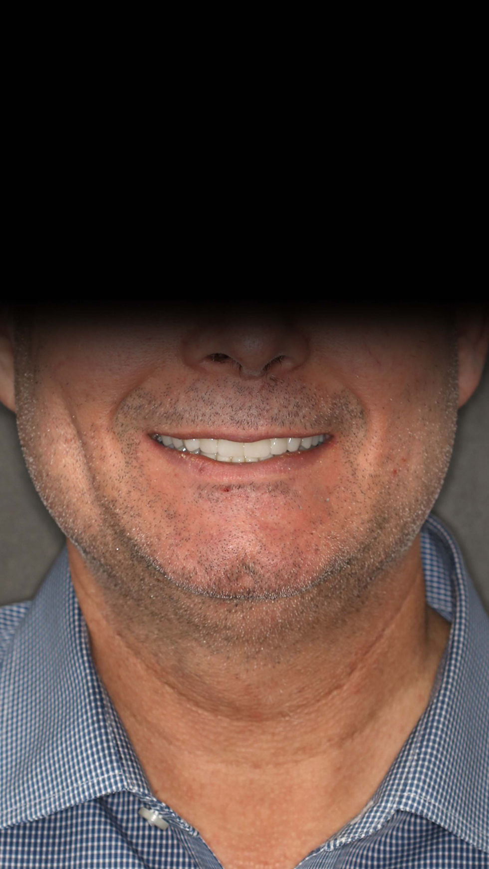 CM - RS - Shadow.jpg