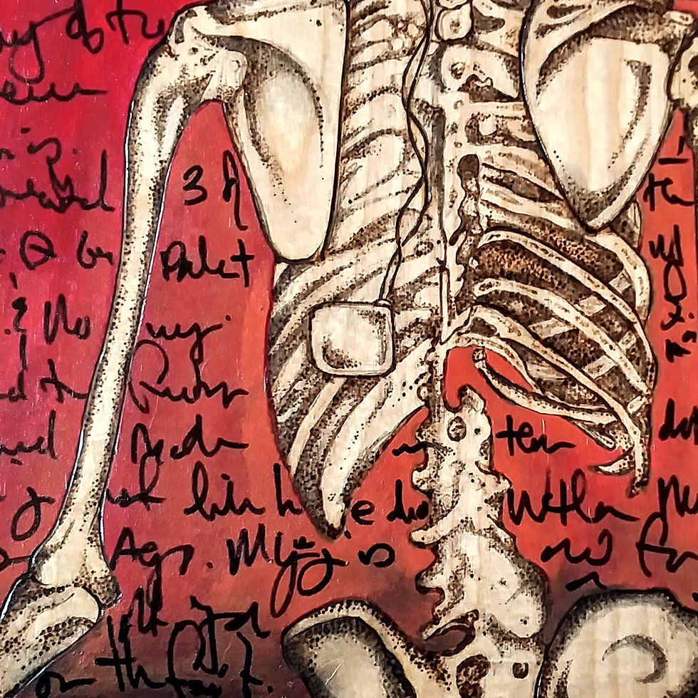 Thumbnail: SOLD - Nerve Damage - Red - Woodburn