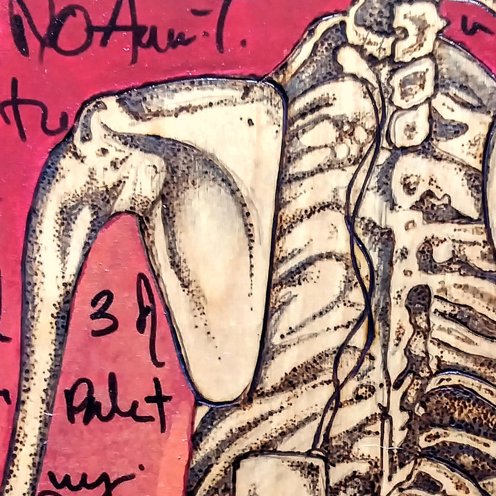 Thumbnail: SOLD - Nerve Damage - Red - Woodburn