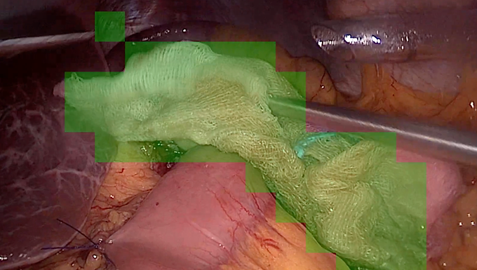 Computer Vision–Based Detection and Tracking of Surgical Gauze in Operative Videos