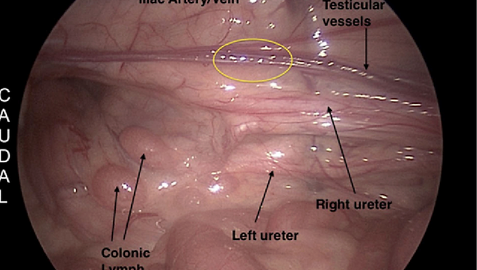 Computer Vision–Based Identification of Lymph Nodes in Surgical and Endoscopic Videos