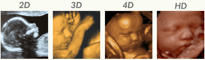 2d3d4d_animated_gif.gif