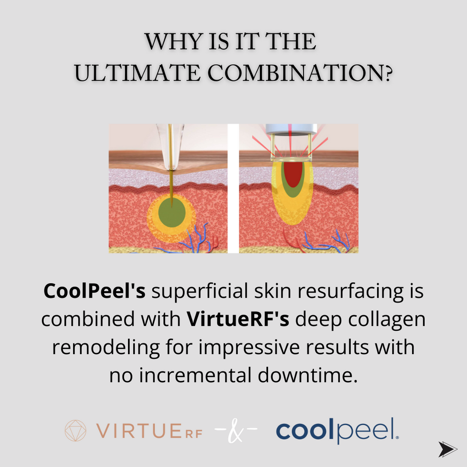 CoolPeel CO2 Laser