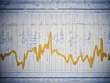 EKG Technician. Become a Certified EKG Technician in New York