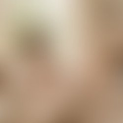 C-Section Recovery in Los Angeles: What to Expect and How to Heal Well