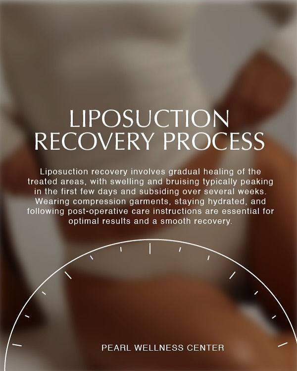 Liposuction Recovery: Timeline, Treatment Area & Plastic Surgery