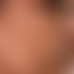 Understanding Pigmentation: Types and Treatments at InnaSkin