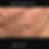 Alma Hybrid Laser COâ‚‚ before and after results at InnaSkin in Sydney Redfern